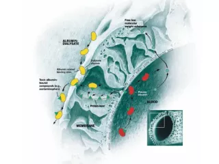 Close-up of MARS memebrane